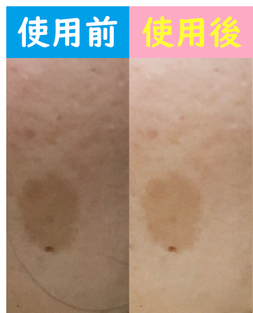 使用前使用後画像
