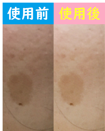 使用前使用後画像